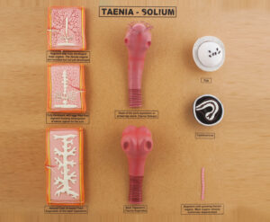 Large Tape Worm Taenia Solium Scolex