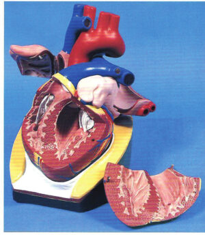 Heart Model 5-Parts Model