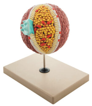 Cholesterol Model