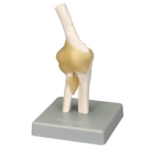 Functional Elbow Joint