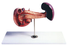 Spleen Pathology Model