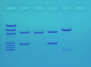 DNA Fingerprinting PCR