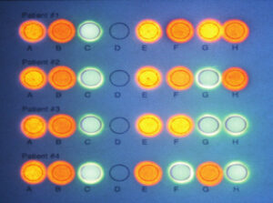 What Is PCR ?