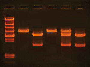 The Cholesterol Gene